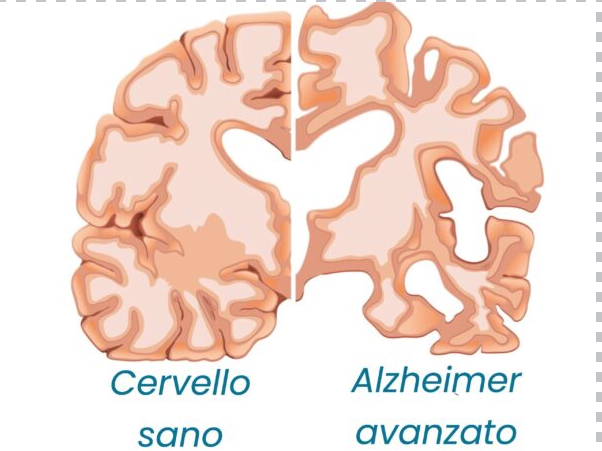 Palestra della mente